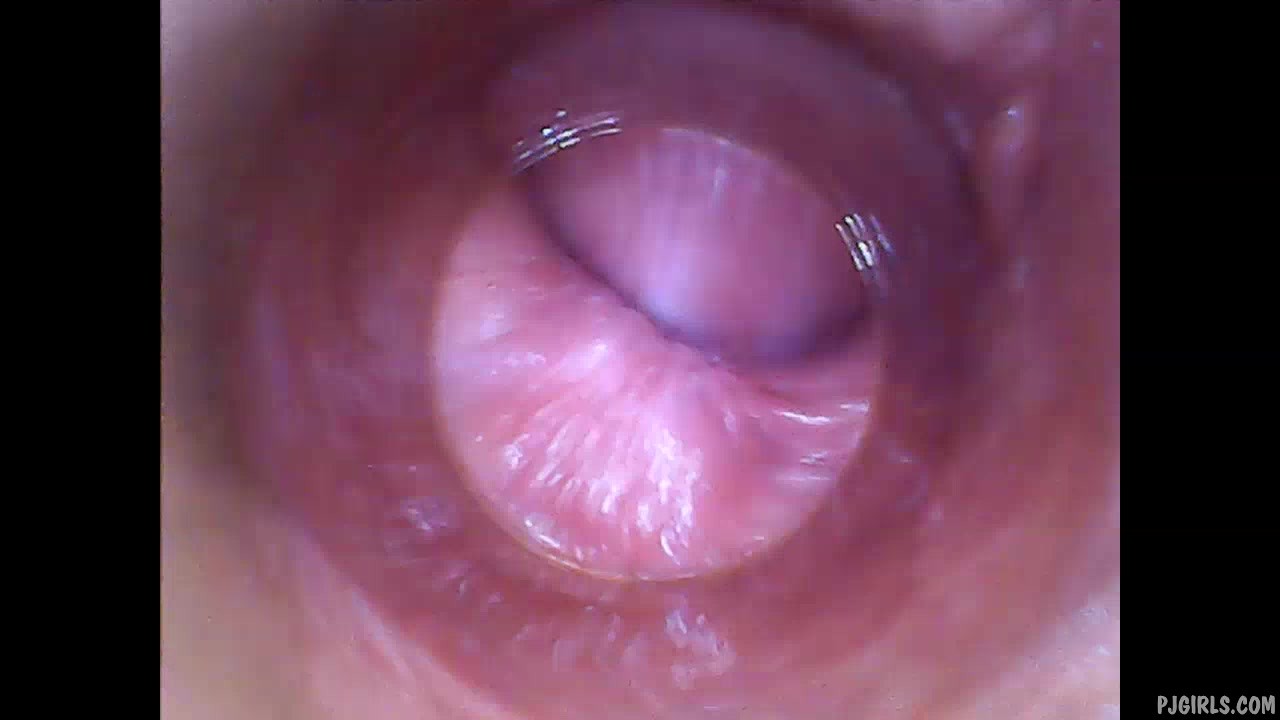 Delphine raw endoscopic video (pussy cam) Â» PornoReino.com
